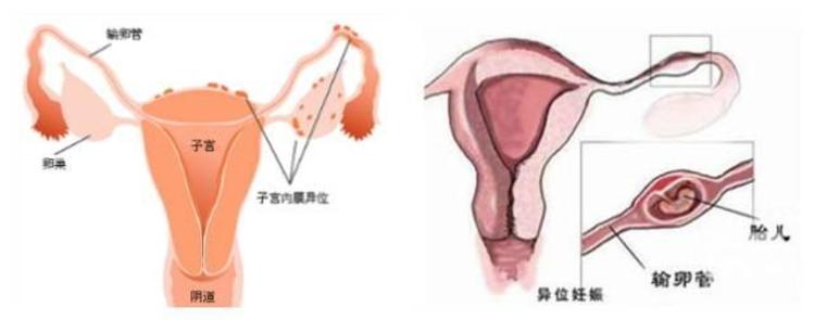 育儿心理在线专家咨询