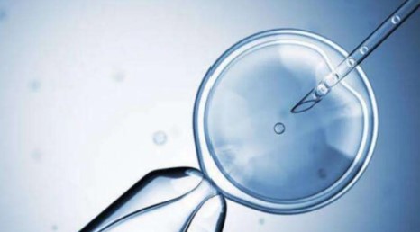 胎儿三个月真实图片